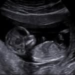 @bluefasebabyy